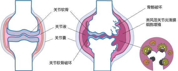 为何会出现变形呢?
