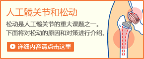 松动是人工髋关节的重大课题之一。下面将对松动的原因和对策进行介绍。