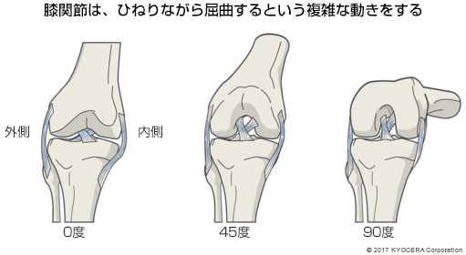 膝関節は、ひねりながら屈曲するという複雑な動きをする