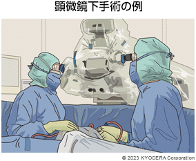 顕微鏡下手術の例