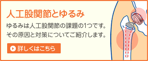人工股関節とゆるみ　ゆるみは人工股関節の課題の1つです。その原因と対策についてご紹介します。