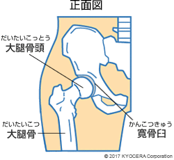 正面図