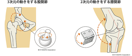 3次元の動きをする股関節,2次元の動きをする膝関節