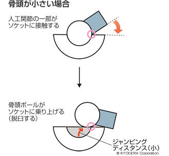 骨頭が小さい場合