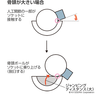 骨頭が大きい場合