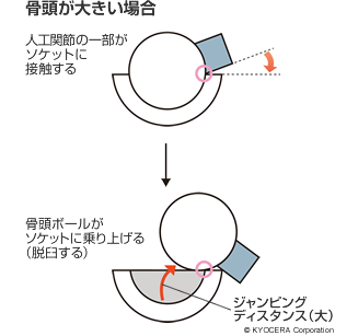 骨頭が大きい場合