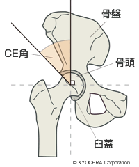 CE角説明 イラスト