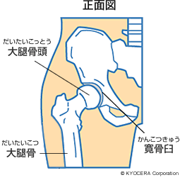 正面図