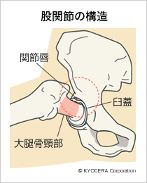 股関節の構造