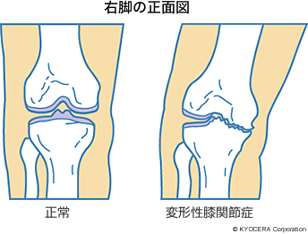 右脚の正面図