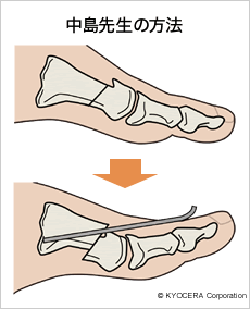 中島先生の方法