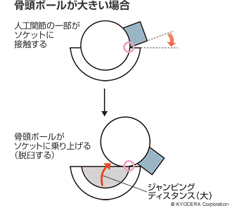 骨頭ボールが大きい場合