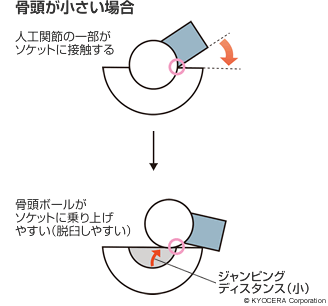 骨頭ボールが小さい場合