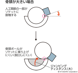 骨頭ボールが大きい場合