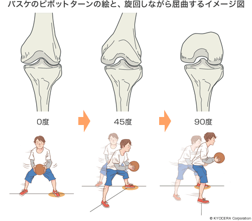 バスケのピボットターンの絵と、旋回しながら屈曲するイメージ図