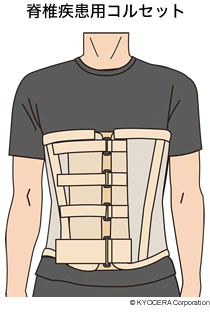 脊椎疾患用コルセット