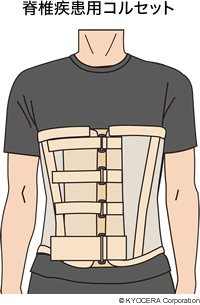 脊椎疾患用コルセット