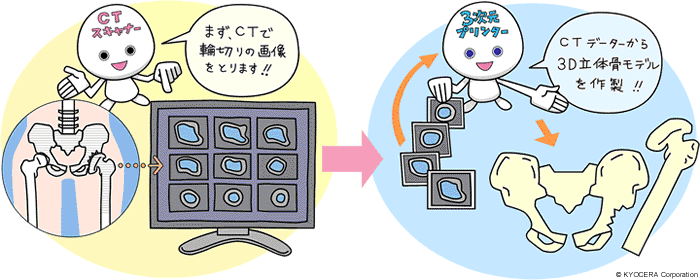 CTスキャナー　三次元プリンタ