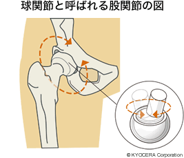 球関節と呼ばれる股関節の図