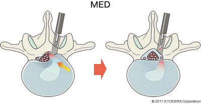 MED