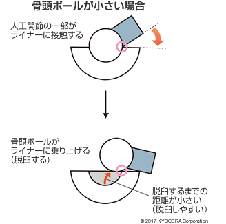 骨頭ボールが小さい場合