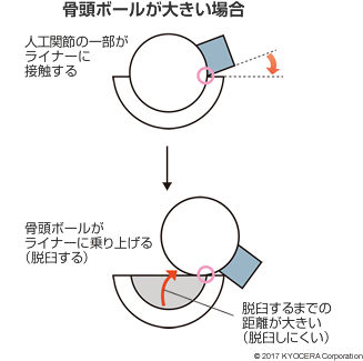 骨頭ボールが大きい場合