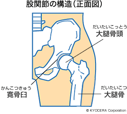 正常な脊椎の断面図、脊柱管狭窄症の断面図