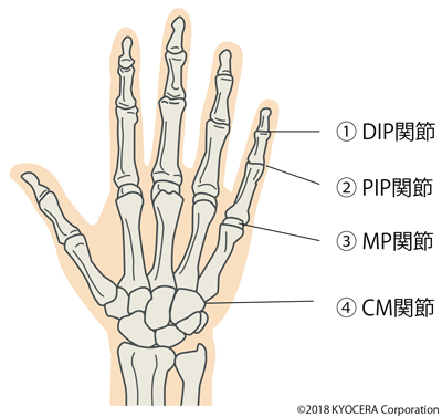 手関節のイラスト