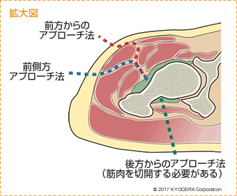 手術手技