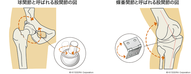 球関節よ呼ばれる股関節の図