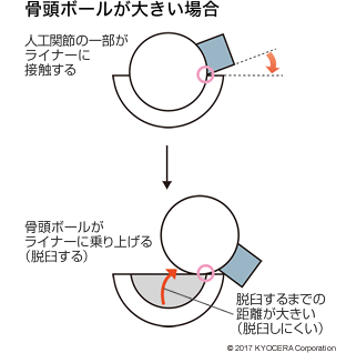 骨頭ボールが大きい場合