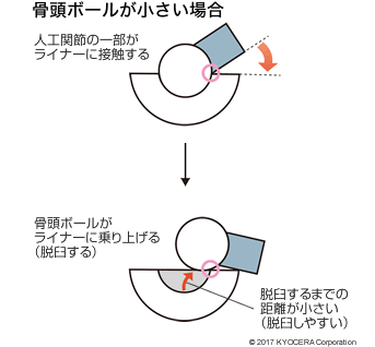 骨頭ボールが小さい場合