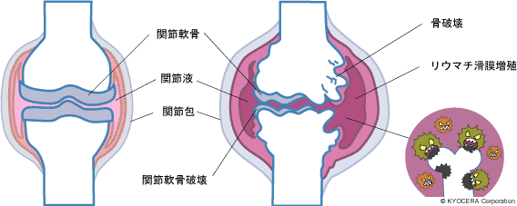 変形が起こる様子