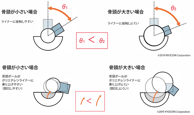 ポリエチレンライナー