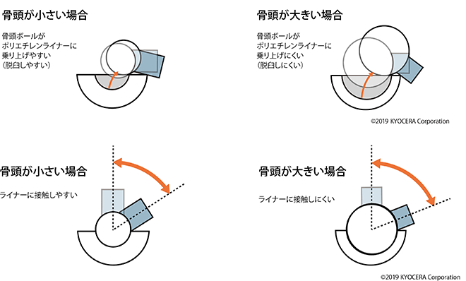 ポリエチレンライナ