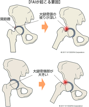 【FAIが起こる要因】