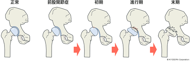 股関節の代表的な疾患にはどのようなものがあるのですか？