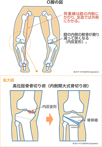 治療法についても説明ください。