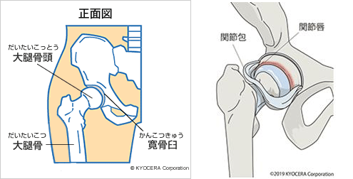 林 申也 劇的な進歩を遂げてきた人工股関節は 今や完成形といえます 長期成績があり 安心して受けられる手術になっています 先生があなたに伝えたいこと 人工関節と関節痛の情報サイト 関節が痛い Com