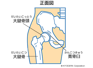 正面図