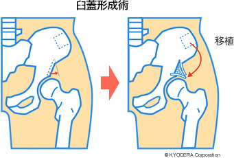 䯨 賢一 股関節の難しい疾患を抱えている方 必ず治療法がありますのであきらめないでください 治療のゴールは 手術したことを忘れさせるほど機能を回復させることです 先生があなたに伝えたいこと 人工関節と関節痛の情報サイト 関節が痛い Com