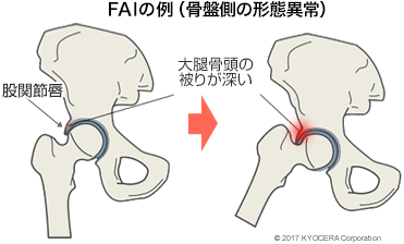 䯨 賢一 股関節の難しい疾患を抱えている方 必ず治療法がありますのであきらめないでください 治療のゴールは 手術したことを忘れさせるほど機能を回復させることです 先生があなたに伝えたいこと 人工関節と関節痛の情報サイト 関節が痛い Com