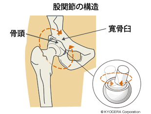 股関節の構造