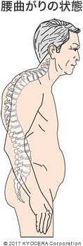 腰曲がりの状態