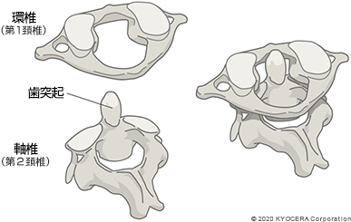 環椎（第1頚椎） 歯突起 軸椎（第2頚椎）