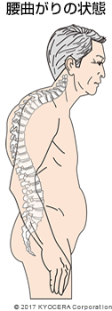 腰曲がりの状態