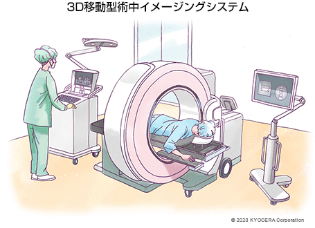 3D移動型術中イメージングシステム