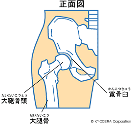 正面図