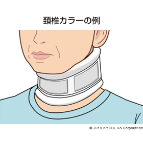 頚椎カラーの例