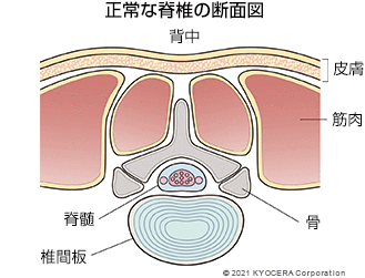 正常な脊椎の断面図